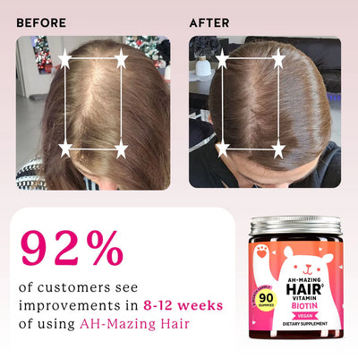 Nutria™ Biotin Hair Gummies