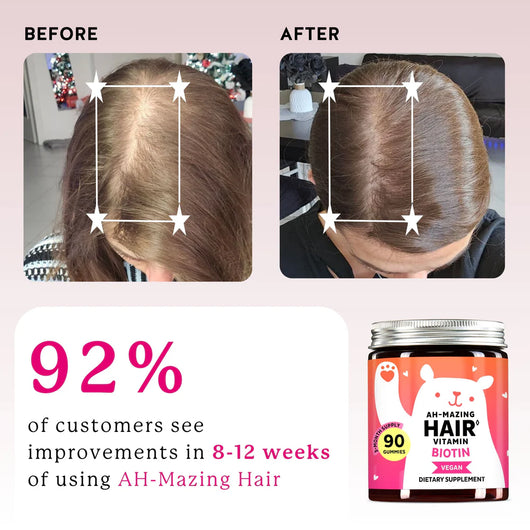 Nutria™ Biotin Hair Gummies