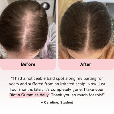 Nutria™ Biotin Hair Gummies